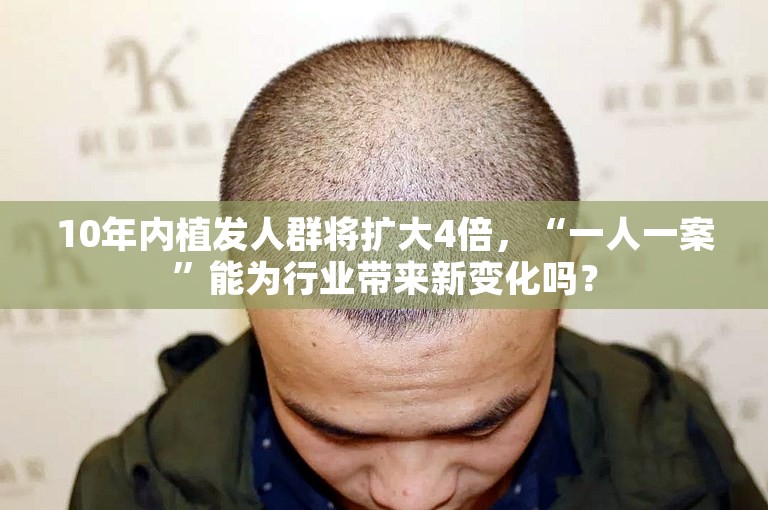 10年内植发人群将扩大4倍,“一人一案”能为行业带来新变化吗? 10年内植发人群将扩大4倍,“一人一案”能为行业带来新变化吗?
