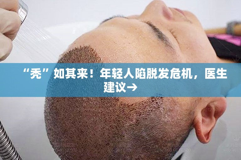 “秃”如其来！年轻人陷脱发危机，医生建议→