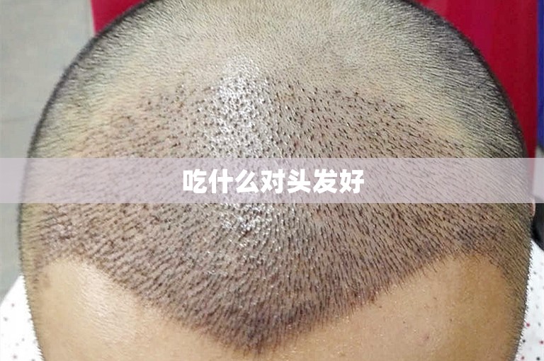 吃什么对头发好 吃什么对头发好