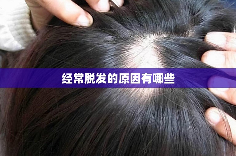 经常脱发的原因有哪些