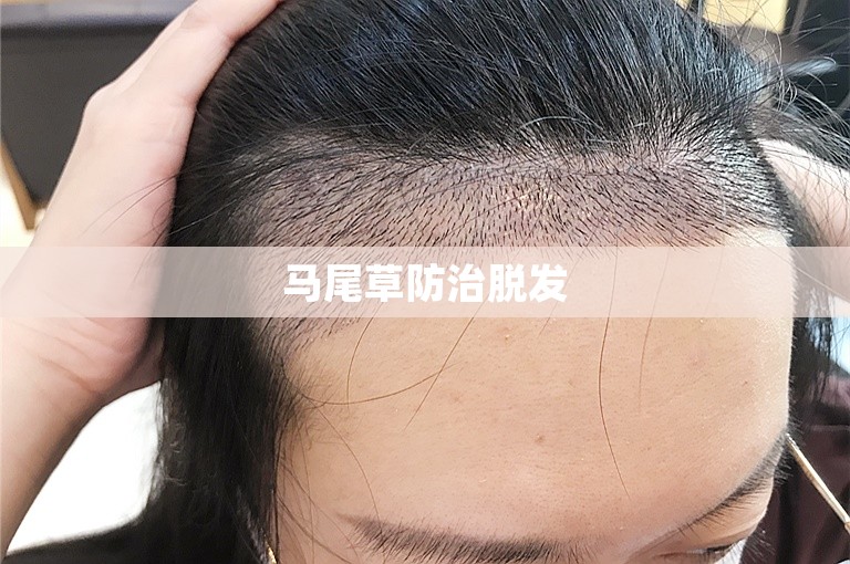 马尾草防治脱发 马尾草防治脱发