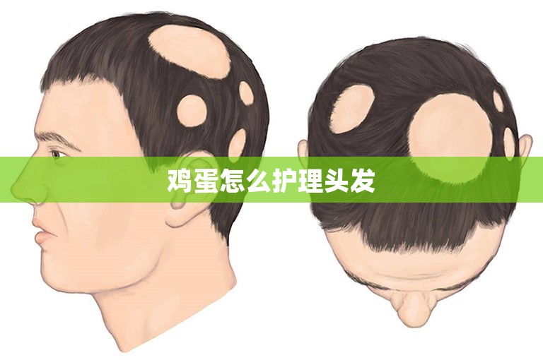 鸡蛋怎么护理头发 鸡蛋怎么护理头发