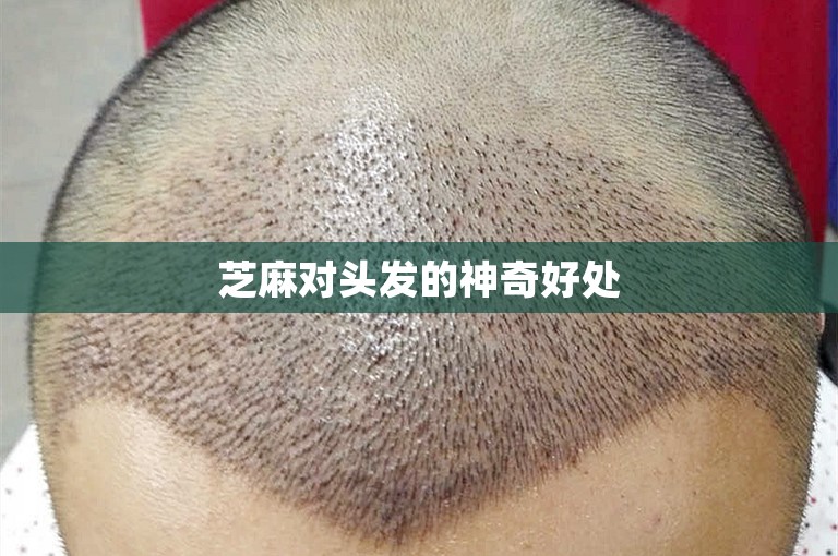 芝麻对头发的神奇好处