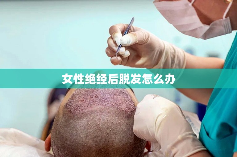女性绝经后脱发怎么办