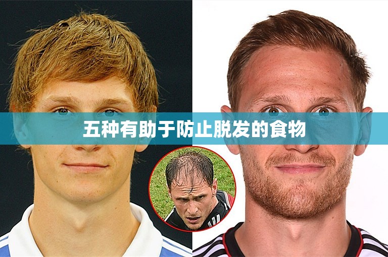 五种有助于防止脱发的食物