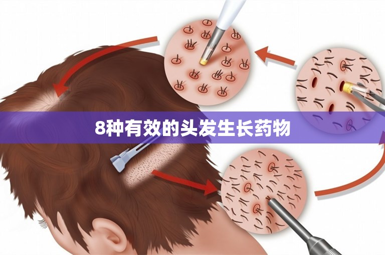 8种有效的头发生长药物