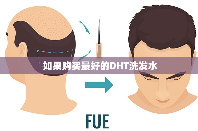  如果购买最好的DHT洗发水