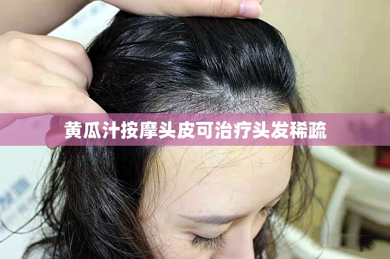 黄瓜汁按摩头皮可治疗头发稀疏 黄瓜汁按摩头皮可治疗头发稀疏