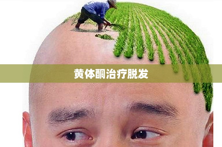 黄体酮治疗脱发 黄体酮治疗脱发