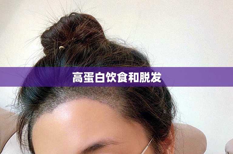 高蛋白饮食和脱发 高蛋白饮食和脱发