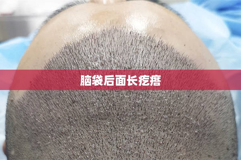 脑袋后面长疙瘩