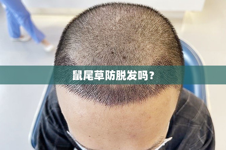 鼠尾草防脱发吗？