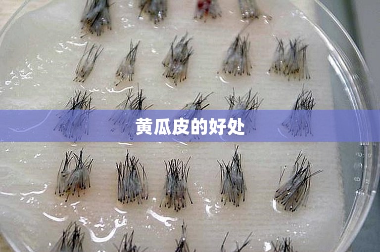 黄瓜皮的好处 黄瓜皮的好处