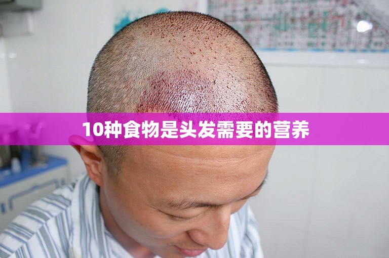 10种食物是头发需要的营养 10种食物是头发需要的营养