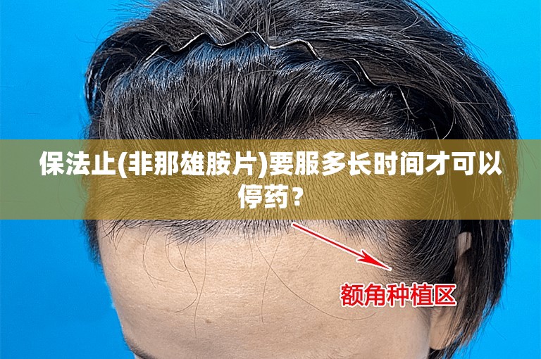 保法止(非那雄胺片)要服多长时间才可以停药？