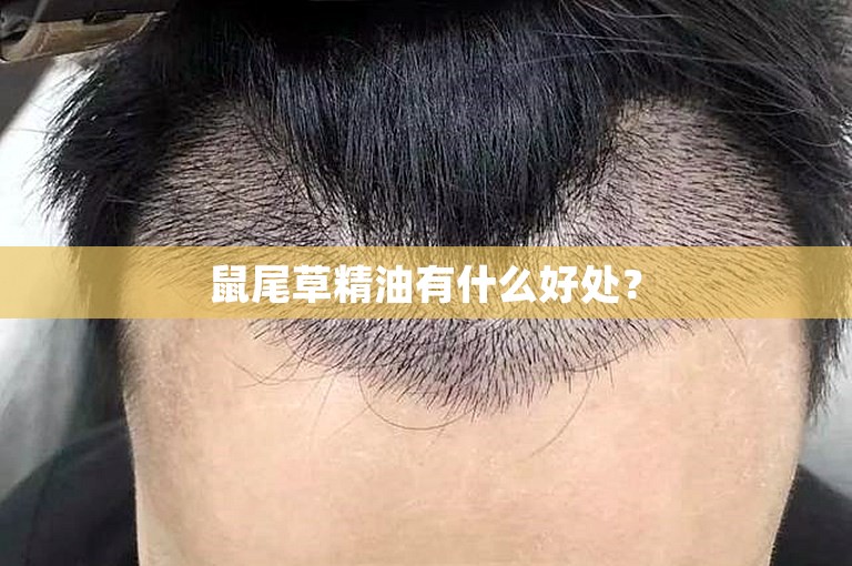 鼠尾草精油有什么好处? 鼠尾草精油有什么好处?