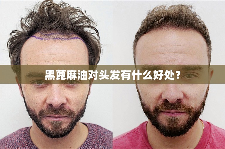 黑蓖麻油对头发有什么好处? 黑蓖麻油对头发有什么好处?