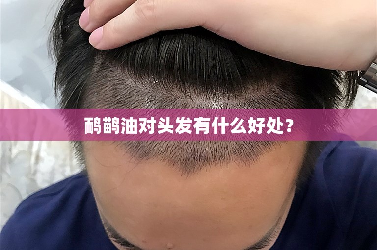 鸸鹋油对头发有什么好处？