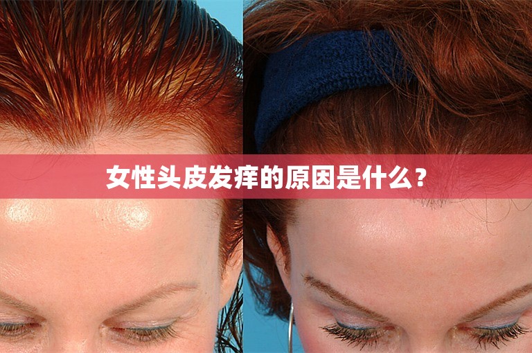 女性头皮发痒的原因是什么？