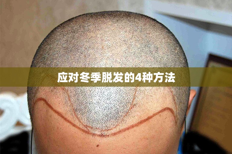 应对冬季脱发的4种方法