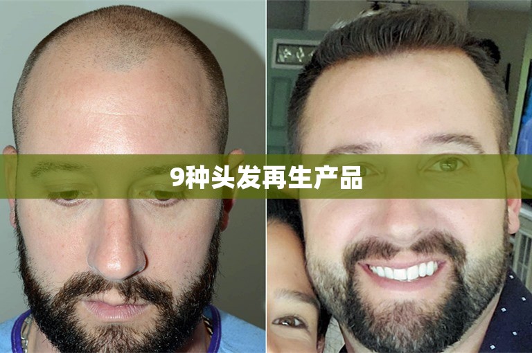 9种头发再生产品 9种头发再生产品