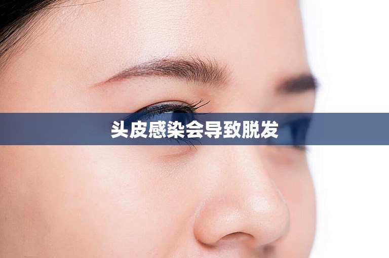 头皮感染会导致脱发 头皮感染会导致脱发