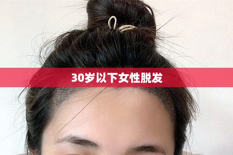30岁以下女性脱发 30岁以下女性脱发