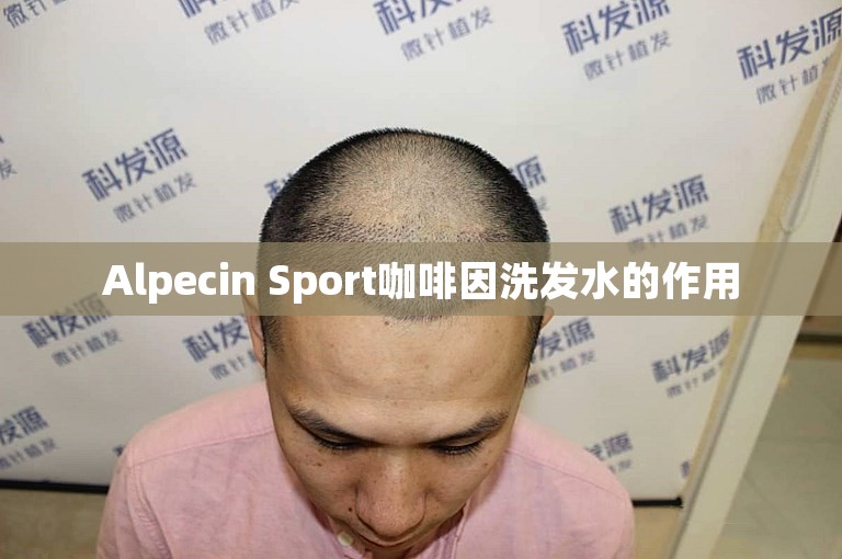 Alpecin Sport咖啡因洗发水的作用 Alpecin Sport咖啡因洗发水的作用
