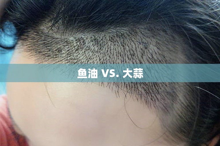 鱼油 VS. 大蒜 鱼油 VS. 大蒜