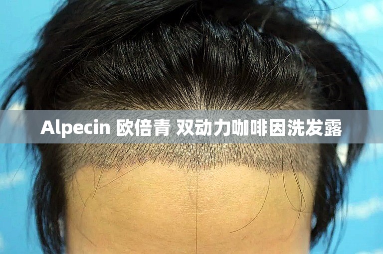 Alpecin 欧倍青 双动力咖啡因洗发露 Alpecin 欧倍青 双动力咖啡因洗发露