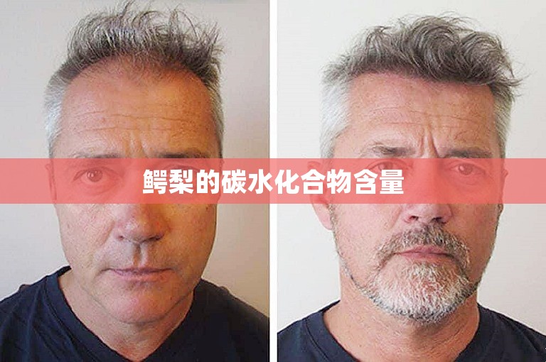 鳄梨的碳水化合物含量 鳄梨的碳水化合物含量
