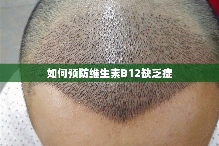 如何预防维生素B12缺乏症