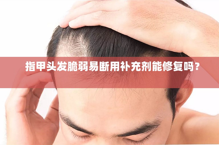 指甲头发脆弱易断用补充剂能修复吗? 指甲头发脆弱易断用补充剂能修复吗?