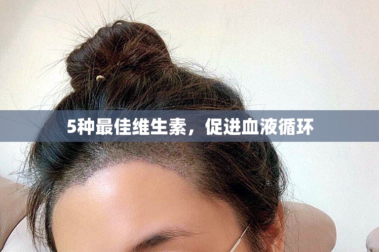 5种最佳维生素，促进血液循环