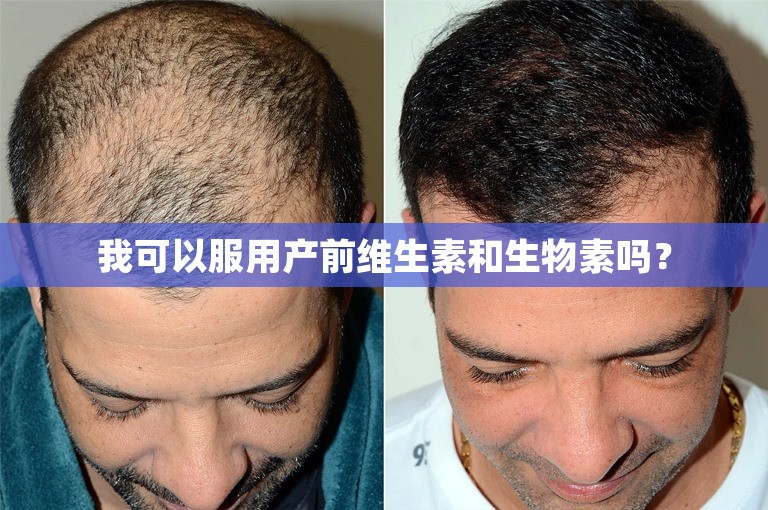 我可以服用产前维生素和生物素吗？