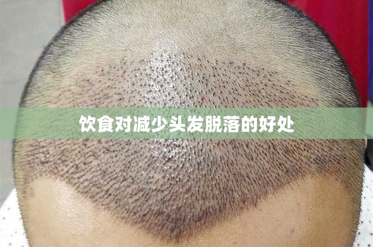 饮食对减少头发脱落的好处 饮食对减少头发脱落的好处