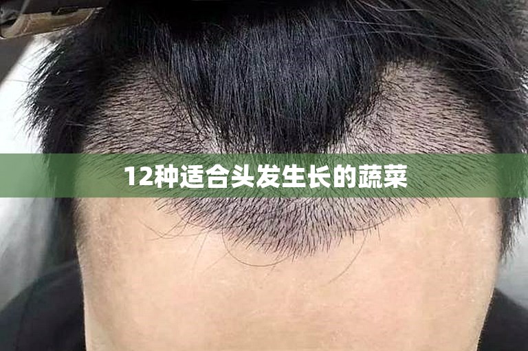 12种适合头发生长的蔬菜