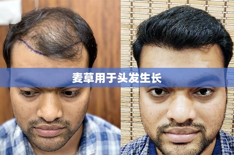 麦草用于头发生长