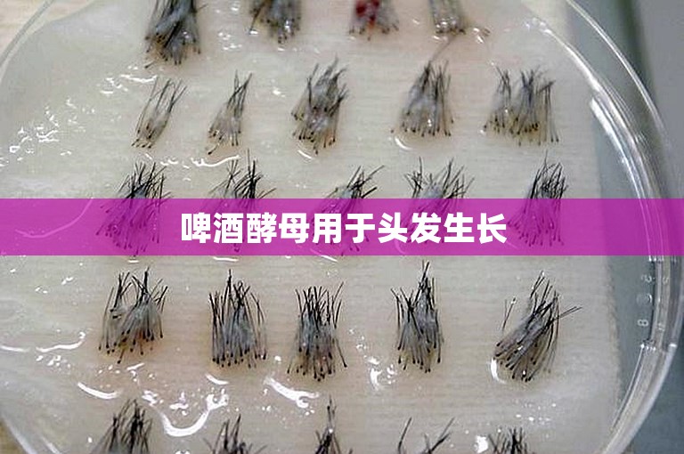 啤酒酵母用于头发生长