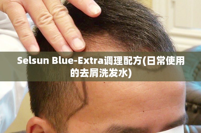 Selsun Blue-Extra调理配方(日常使用的去屑洗发水)
