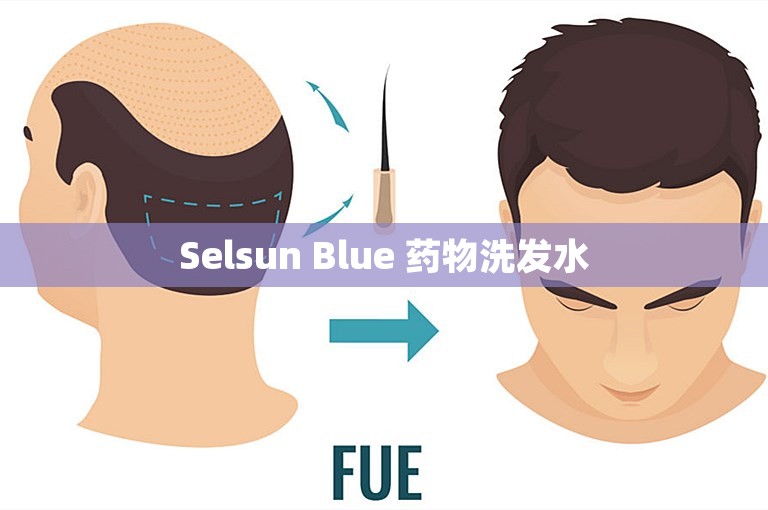 Selsun Blue 药物洗发水