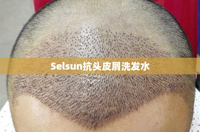 Selsun抗头皮屑洗发水