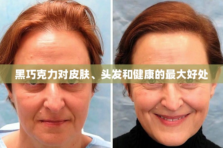 黑巧克力对皮肤、头发和健康的最大好处