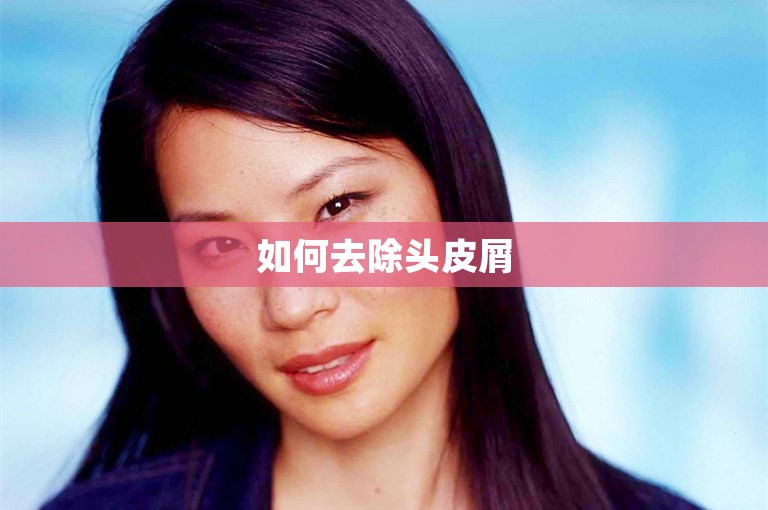 如何去除头皮屑