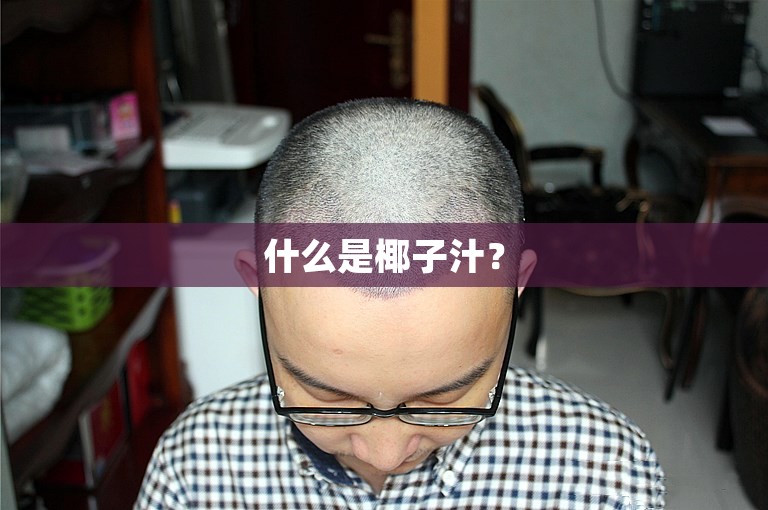 什么是椰子汁？