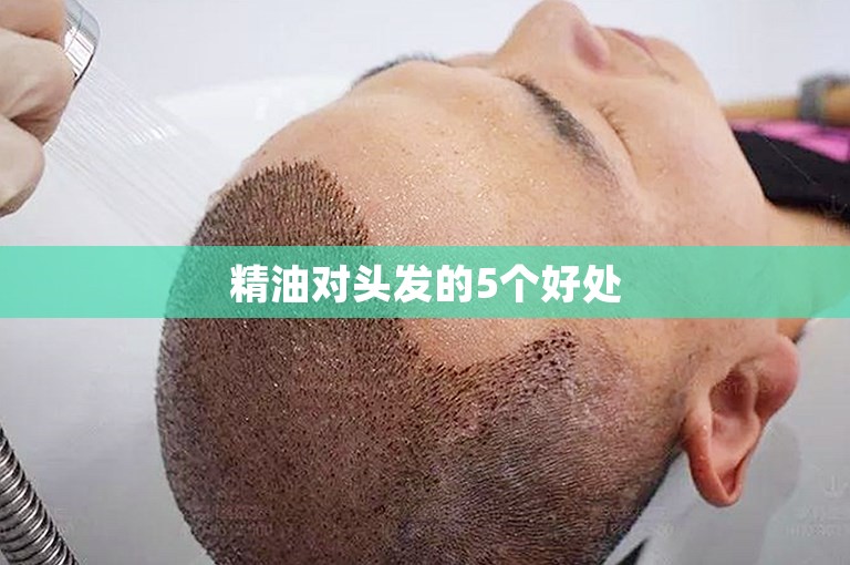 精油对头发的5个好处