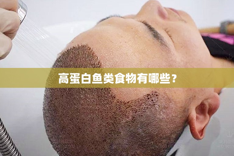 高蛋白鱼类食物有哪些? 高蛋白鱼类食物有哪些?