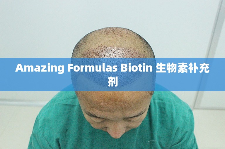 Amazing Formulas Biotin 生物素补充剂 Amazing Formulas Biotin 生物素补充剂