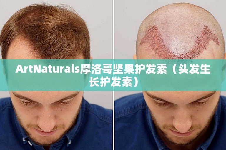ArtNaturals摩洛哥坚果护发素(头发生长护发素) ArtNaturals摩洛哥坚果护发素(头发生长护发素)