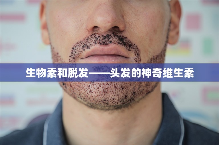 生物素和脱发——头发的神奇维生素